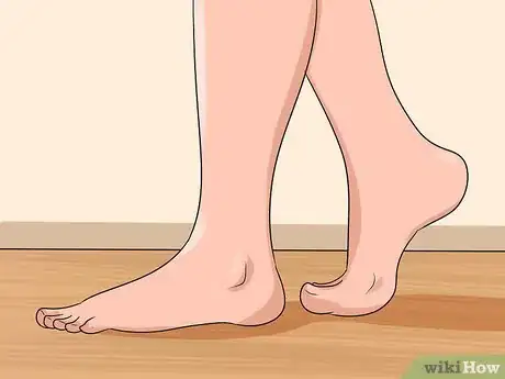 Imagen titulada Get Rid of Bunions Step 1