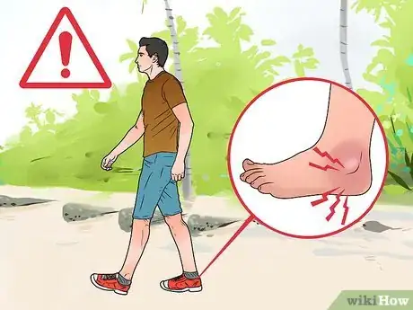 Imagen titulada Cure a Gout Attack Step 2