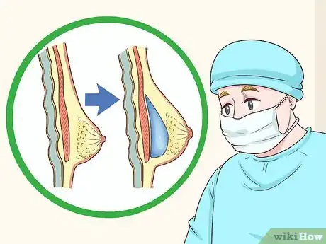 Imagen titulada Fix Imbalanced Breast Sizes Step 4