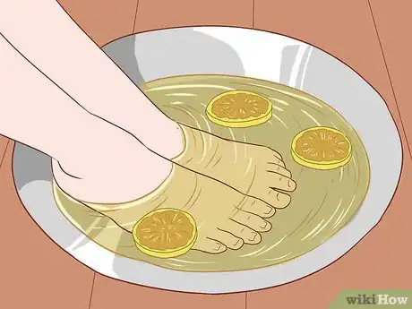 Imagen titulada Get Rid of Calluses on Feet Step 12