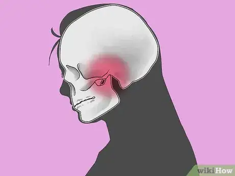 Imagen titulada Reduce Jaw Pain Step 8