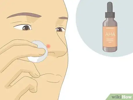 Image intitulée Get Rid of Acne Redness Fast Step 9