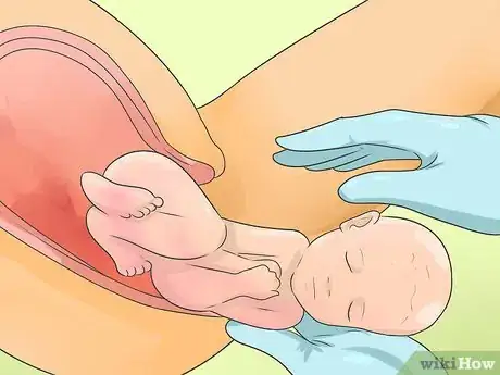 Image intitulée Deliver a Baby Step 10