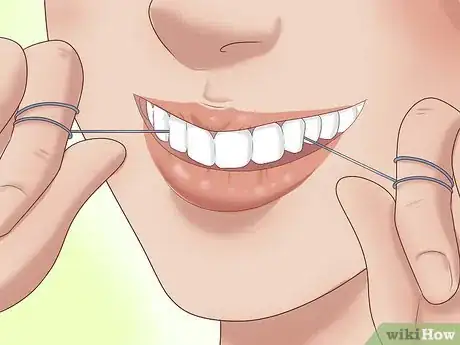 Image intitulée Have the Perfect Smile Step 8