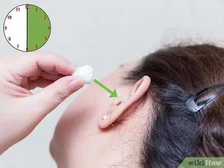 Image intitulée Make a Homemade Ear Cleaner Step 11