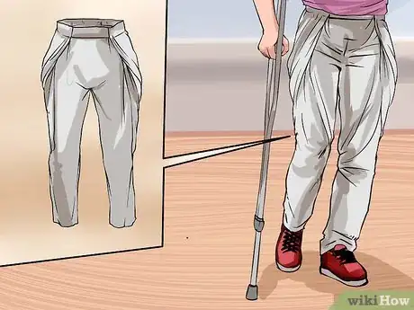 Image intitulée Deal With a Dislocated Knee Step 16