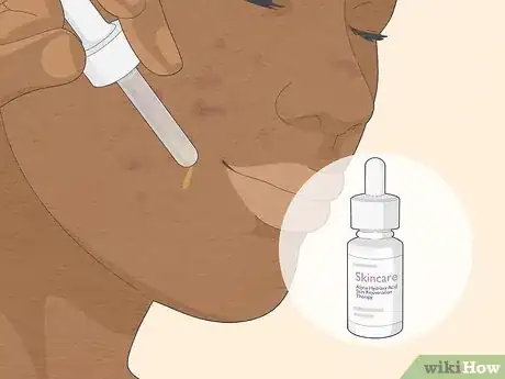 Image intitulée Get Rid of Cystic Acne Scars Step 7