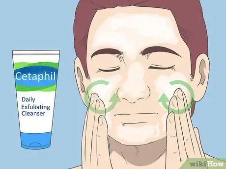 Image intitulée Get Rid of Acne if You Have Fair Skin Step 16