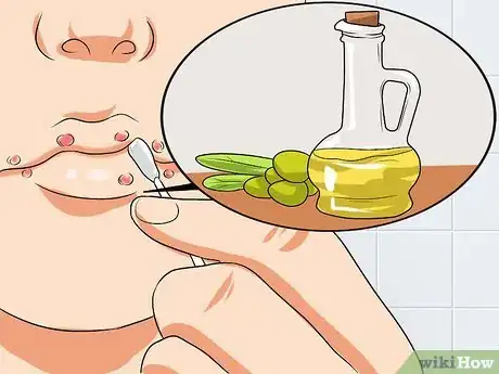 Image intitulée Ease Herpes Pain with Home Remedies Step 6