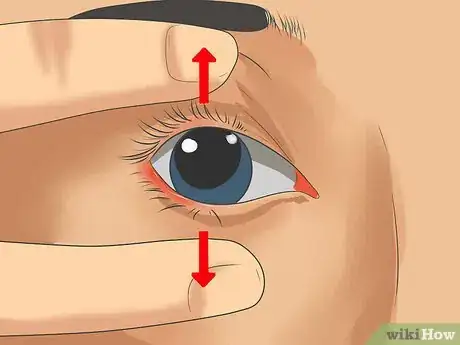 Image intitulée Use Contact Lenses Step 14