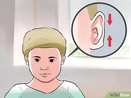 Image intitulée Recognize the Signs of Down Syndrome Step 10