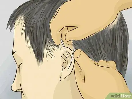 Image intitulée Help Your Hair Grow Faster when You Have a Bald Spot Step 8