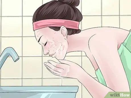 Image intitulée Dry Out a Pimple Step 3