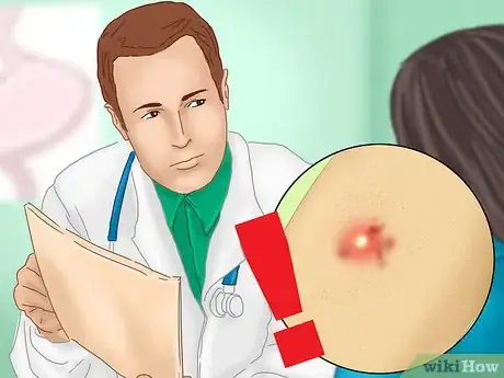 Image intitulée Treat a Staph Infection Step 2