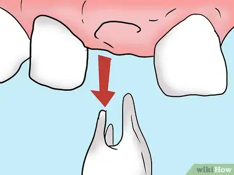 Image intitulée Get Rid of Tooth Pain Step 21