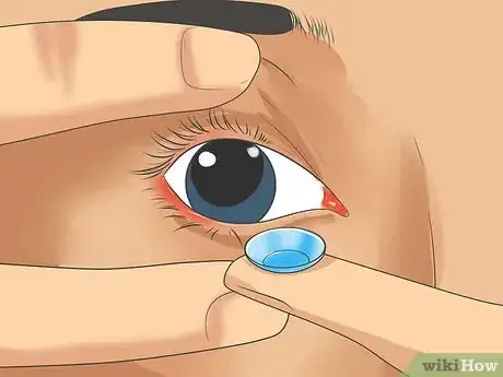 Image intitulée Use Contact Lenses Step 15