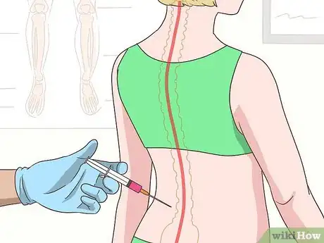 Image intitulée Get Rid of Back Pain Step 11