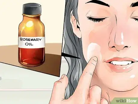 Image intitulée Get Rid of Acne in One Week Step 12