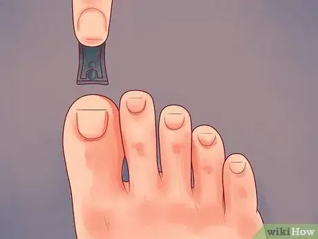 Image intitulée Care for Your Feet and Toenails Step 11