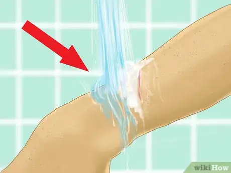 Image intitulée Heal a Cut Due to Dry Skin Step 1