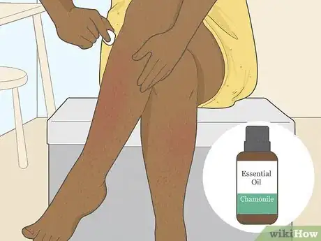 Image intitulée Get Rid of Razor Burn Fast Step 9