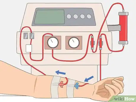 Image intitulée Bring Down High Creatinine Levels Step 22