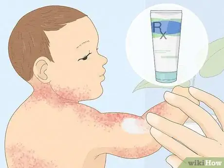 Image intitulée Treat Baby Heat Rash Step 11