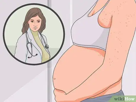 Image intitulée Treat Chicken Pox Step 15