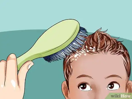 Image intitulée Easily Clean Baby's Cradle Cap Dandruff Without Hurting the Baby Step 3