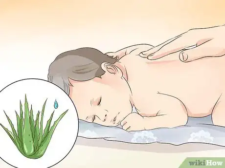 Image intitulée Treat Infant Eczema Naturally Step 10