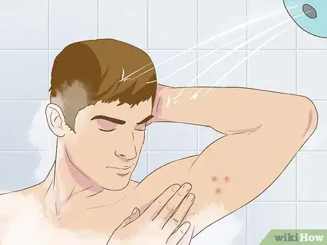 Image intitulée Get Rid of a Zit on Your Armpit Step 1