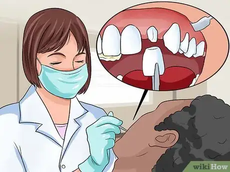 Image intitulée Restore Tooth Enamel Step 8