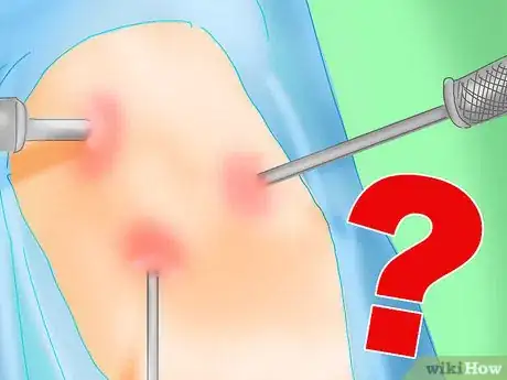 Image intitulée Relieve Wrist Pain Step 11