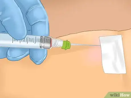 Image intitulée Treat a Staph Infection Step 4