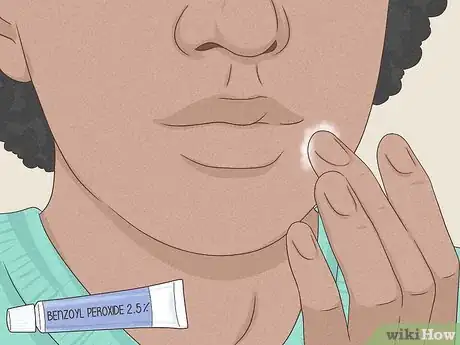 Image intitulée Get Rid of a Zit Overnight Step 2