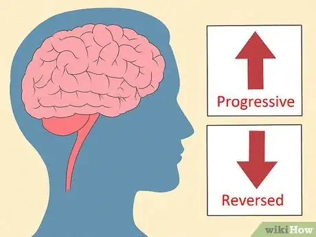 Image intitulée Recognize Signs of Senile Dementia Step 18