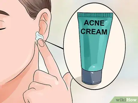 Image intitulée Get Rid of Pimples Inside the Ear Step 5