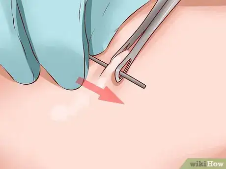 Image intitulée Do a Self Piercing at Home Step 6