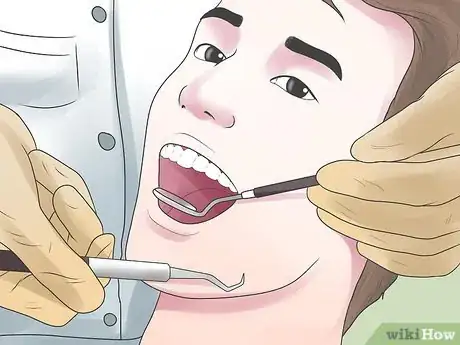 Image intitulée Clean Your Teeth After Wisdom Teeth Removal Step 11