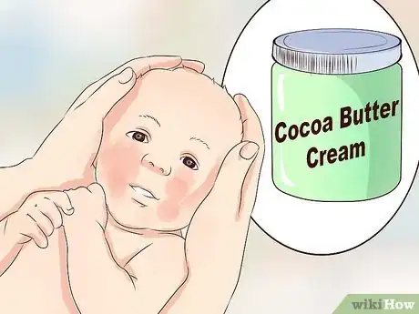 Image intitulée Treat Infant Eczema Naturally Step 11