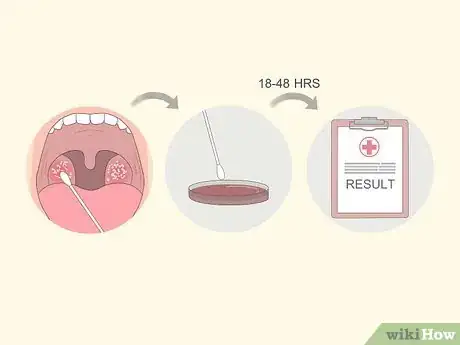 Image intitulée Tell if You Have Strep Throat Step 24