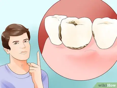 Image intitulée Determine if You Need Braces Step 2