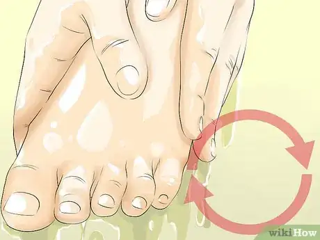 Image intitulée Heal Dry Skin on Your Feet Step 9