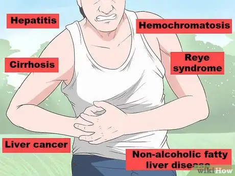 Image intitulée Stop Liver Pain Step 13