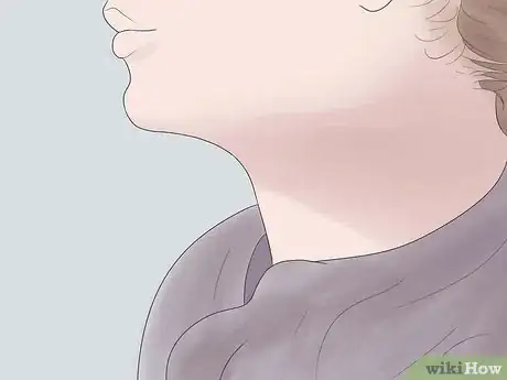 Image intitulée Get Rid of a Hickey Fast Step 11