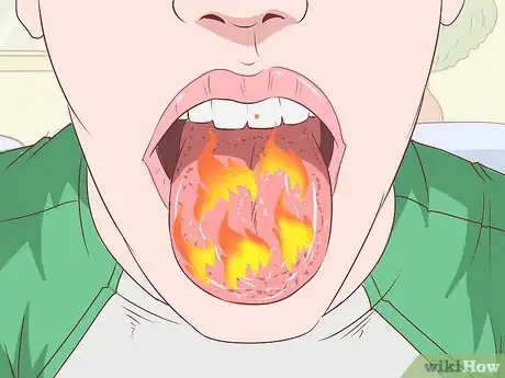 Image intitulée Stop a Burning Throat Step 16