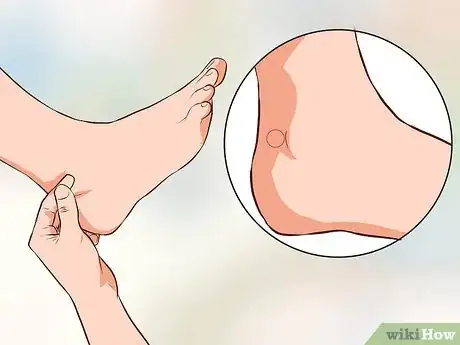 Image intitulée Use Acupressure to Induce Labour Step 9