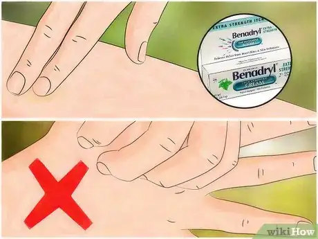 Image intitulée Identify Insect Bites Step 10