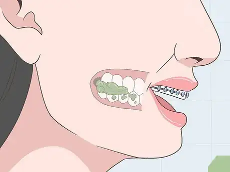 Image intitulée Eat Food With New or Tightened Braces Step 5