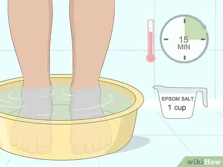 Image intitulée Relieve Ingrown Toe Nail Pain Step 14